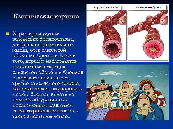 Клиническая картина n Характерны удушье вследствие бронхоспазма, дисфункция дыхательных мышц, отек слизистой оболочки бронхов.
