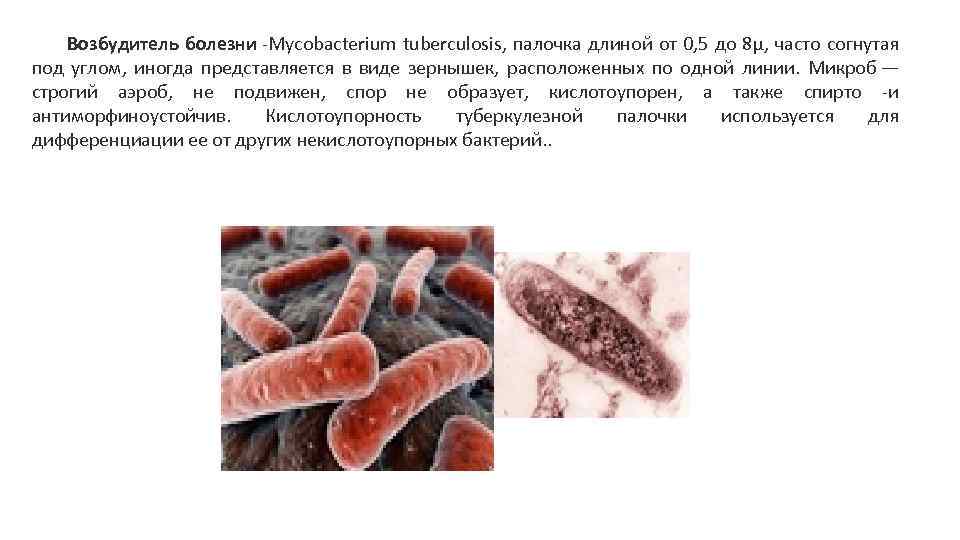 Возбудитель болезни -Mycobacterium tuberculosis, палочка длиной от 0, 5 до 8µ, часто согнутая под