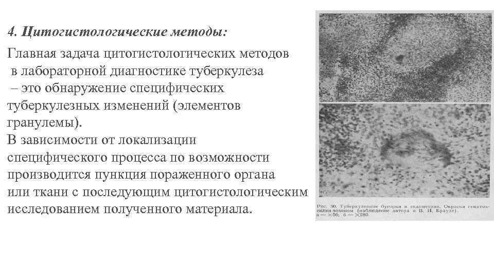 4. Цитогистологические методы: Главная задача цитогистологических методов в лабораторной диагностике туберкулеза – это обнаружение