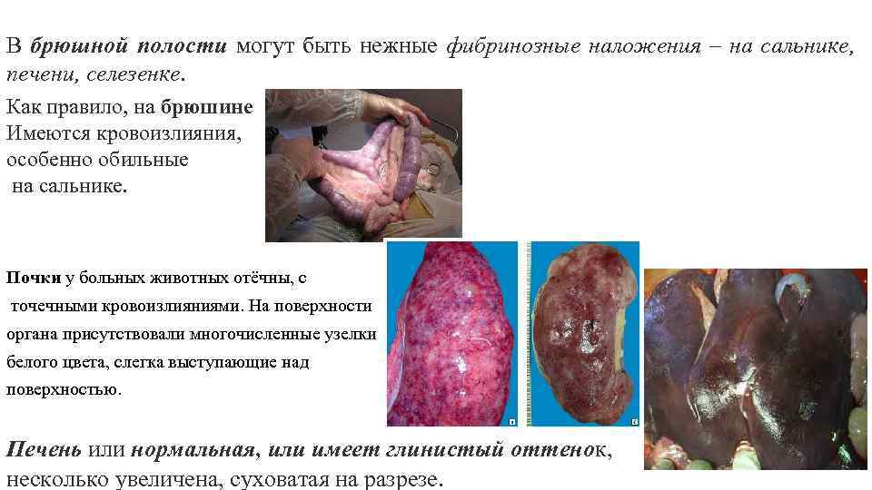 В брюшной полости могут быть нежные фибринозные наложения – на сальнике, печени, селезенке. Как