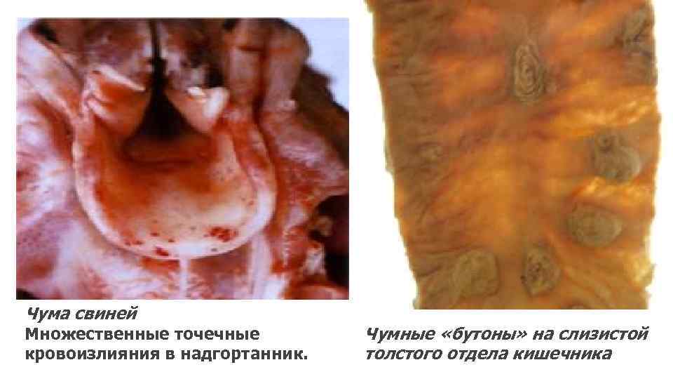 Чума свиней Множественные точечные кровоизлияния в надгортанник. Чумные «бутоны» на слизистой толстого отдела кишечника