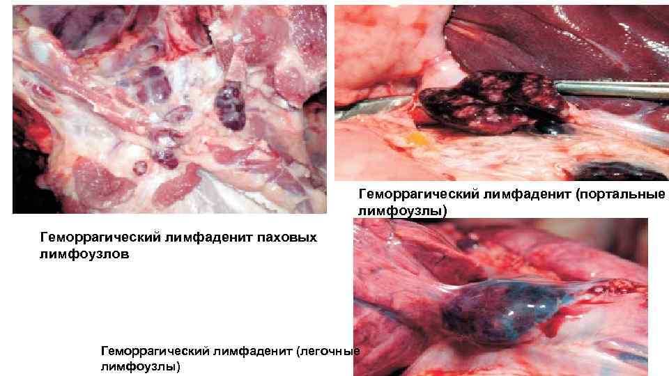 Геморрагический лимфаденит (портальные лимфоузлы) Геморрагический лимфаденит паховых лимфоузлов Геморрагический лимфаденит (легочные лимфоузлы) 