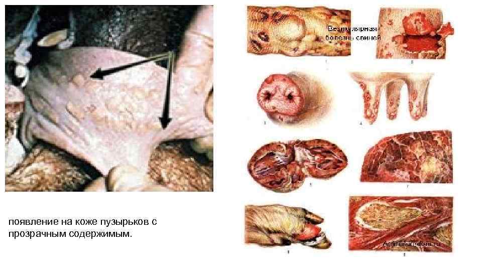 появление на коже пузырьков с прозрачным содержимым. 