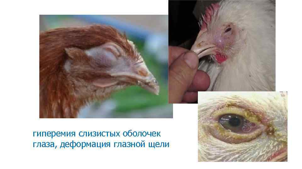 гиперемия слизистых оболочек глаза, деформация глазной щели 