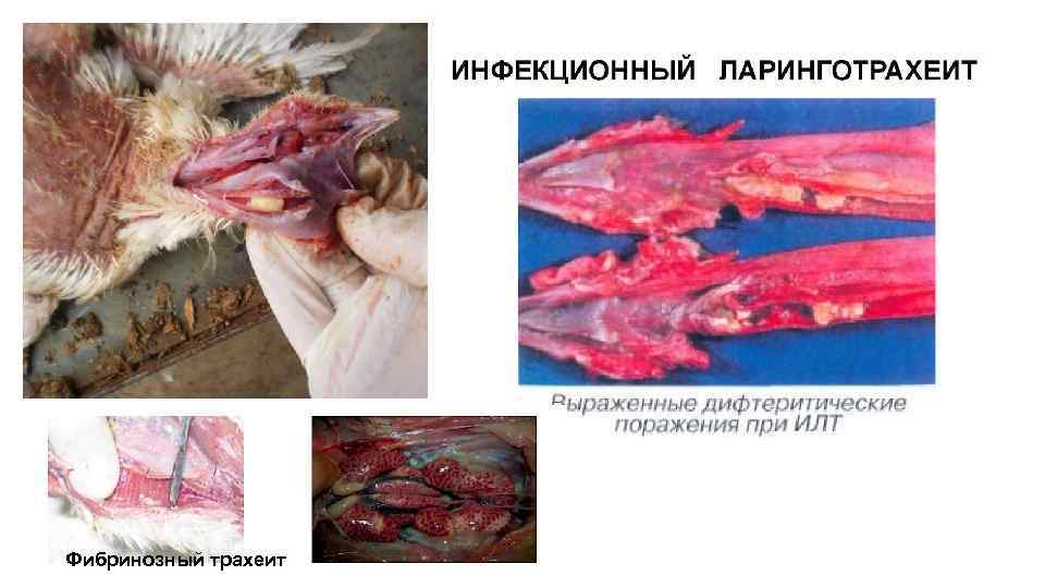 симптомы ИЛТ Фибринозный трахеит 