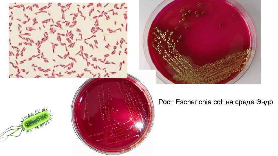 Рост Escherichia coli на среде Эндо.