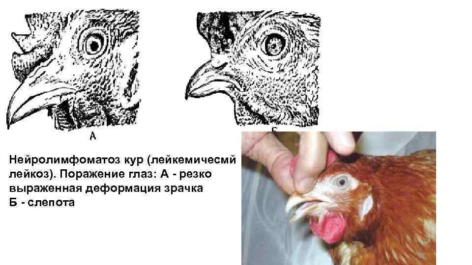 Нейролимфоматоз кур (лейкемичесмй лейкоз). Поражение глаз: А - резко выраженная деформация зрачка Б -