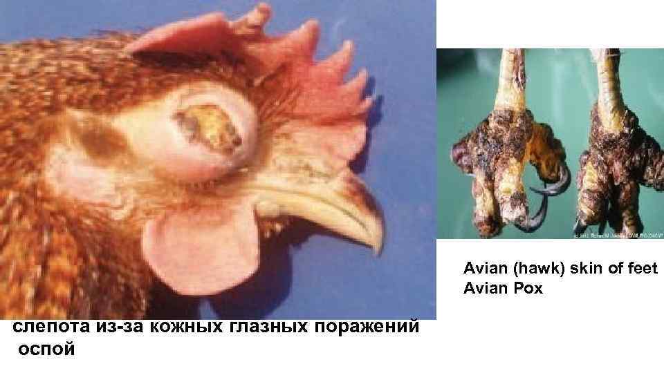 Avian (hawk) skin of feet Avian Pox слепота из-за кожных глазных поражений оспой 