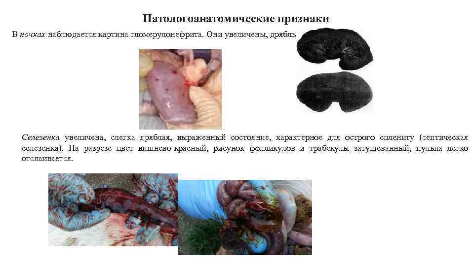 Патологоанатомические признаки. В почках наблюдается картина гломерулонефрита. Они увеличены, дряблые. Селезенка увеличена, слегка дряблая,