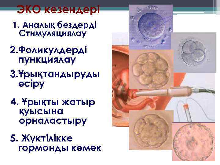 ЭКО кезендері 1. Аналық бездерді Стимуляциялау 2. Фоликулдерді пункциялау 3. Ұрықтандыруды өсіру 4. Ұрықты