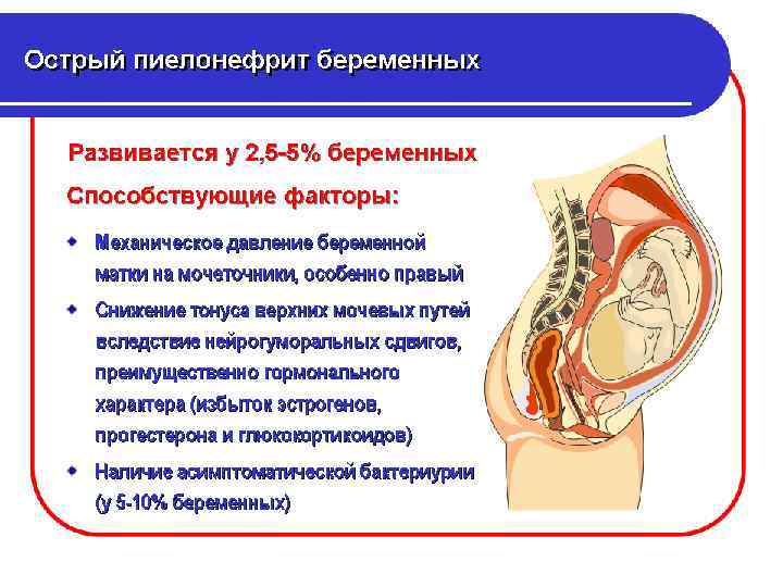 Основные способствующие факторы пузырномочеточникового рефлюкса - Короткая уретра у женщин; - Стаз мочи любой