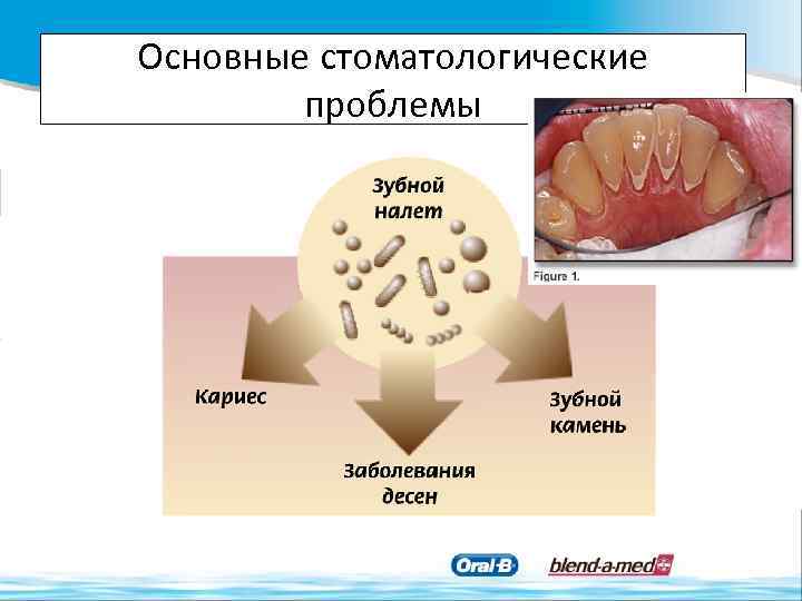 Основные стоматологические проблемы 