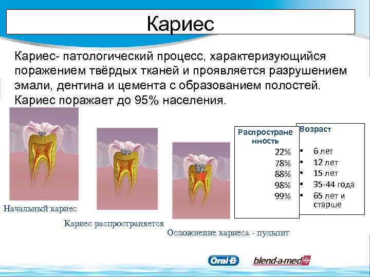 Кариес- патологический процесс, характеризующийся поражением твёрдых тканей и проявляется разрушением эмали, дентина и цемента