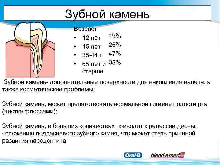 Зубной камень Возраст • 12 лет • 15 лет • 35 -44 г •