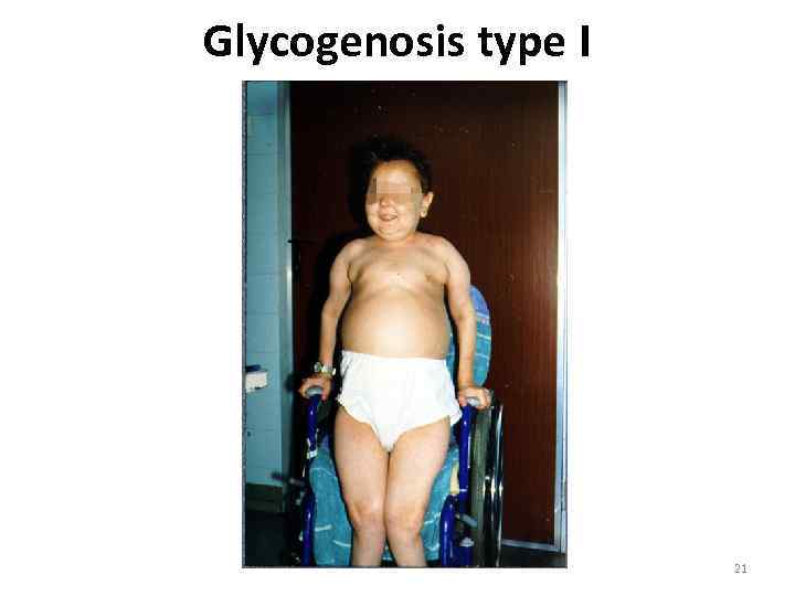 Glycogenosis type I 21 