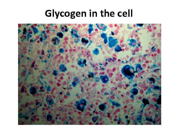 Glycogen in the cell 