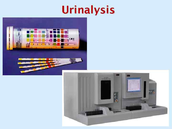 Urinalysis 
