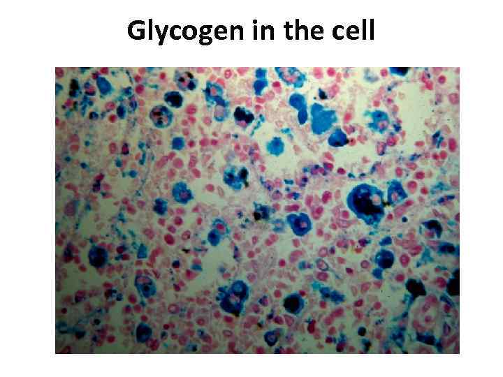 Glycogen in the cell 