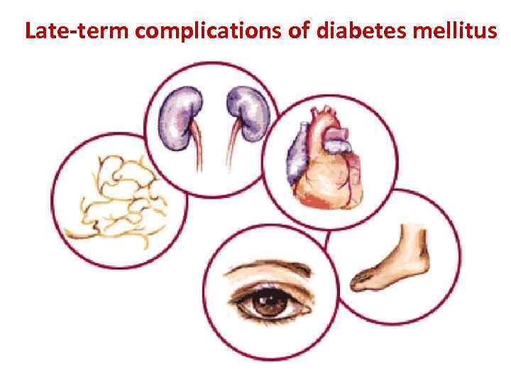 Late-term complications of diabetes mellitus 