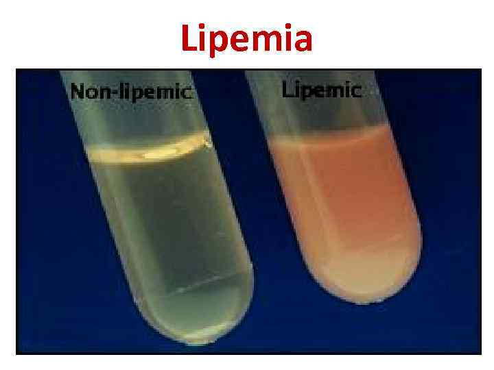 Lipemia 