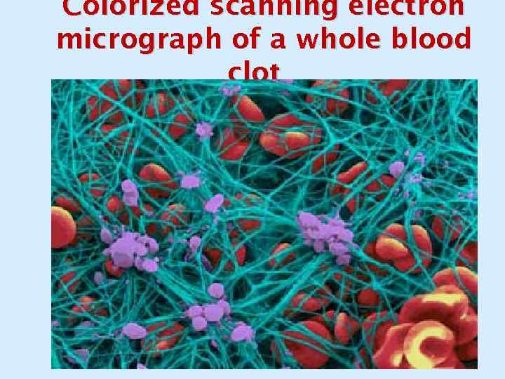 Colorized scanning electron micrograph of a whole blood clot 