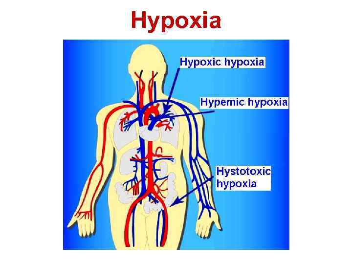 Hypoxia 