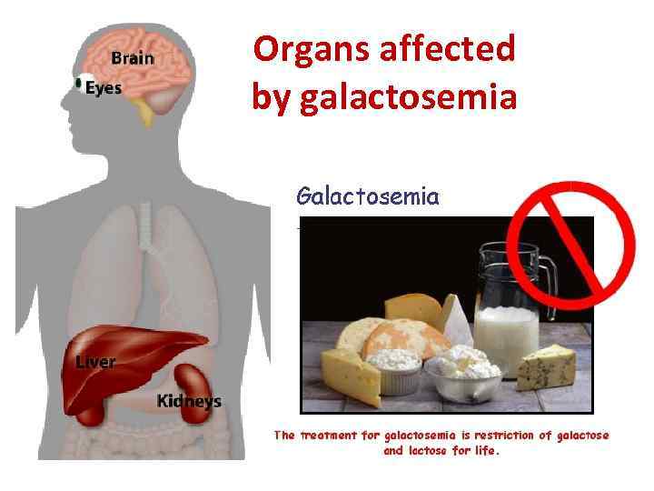 Organs affected by galactosemia 