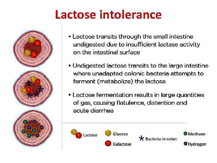 Lactose intolerance 
