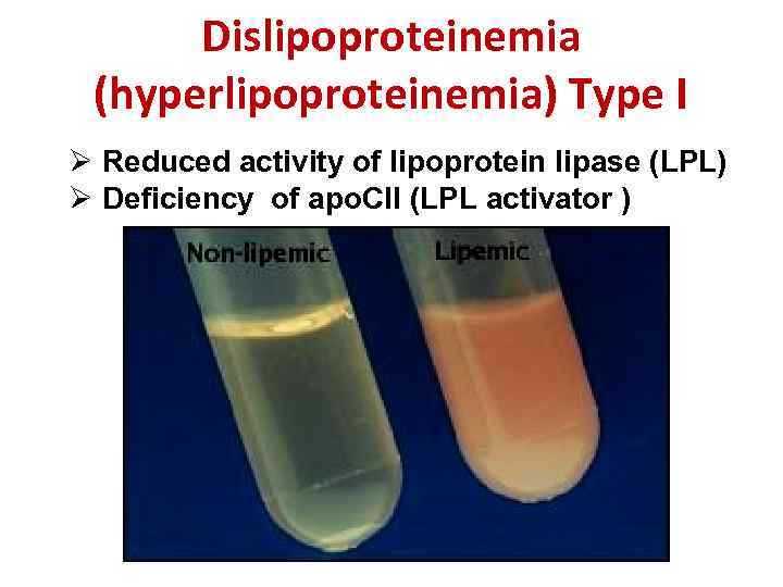 Dislipoproteinemia (hyperlipoproteinemia) Type I Ø Reduced activity of lipoprotein lipase (LPL) Ø Deficiency of