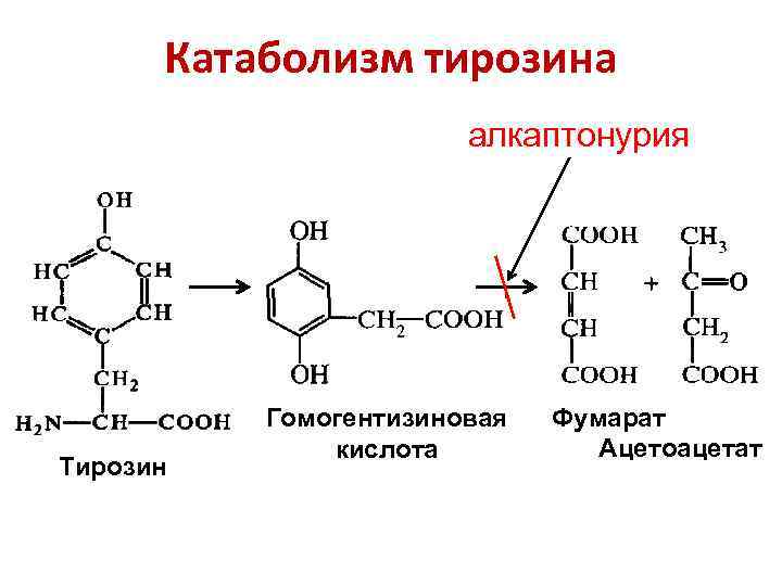 Катаболизм тирозина алкаптонурия Тирозин Гомогентизиновая кислота Фумарат Ацетоацетат 