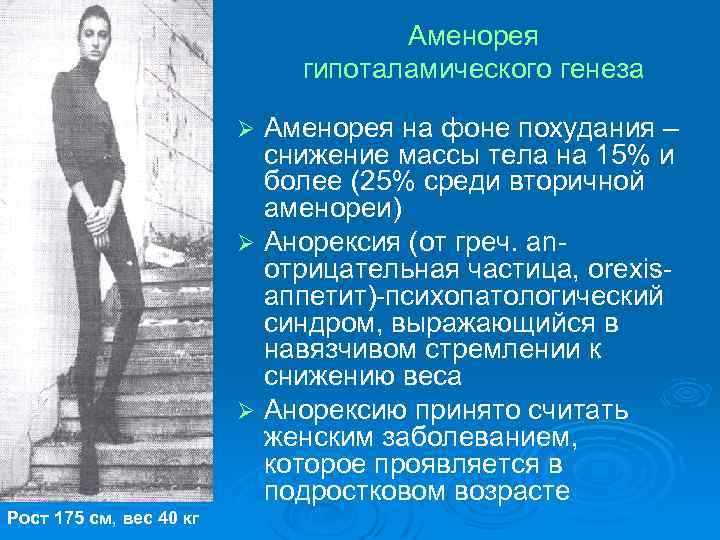 Аменорея гипоталамического генеза Аменорея на фоне похудания – снижение массы тела на 15% и