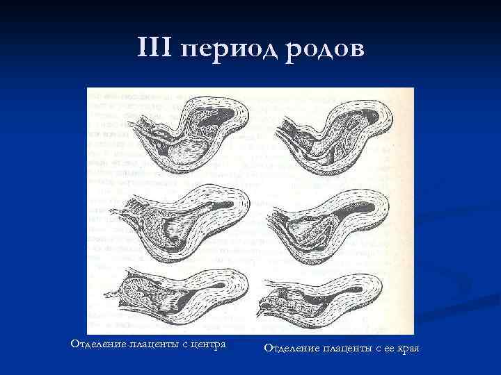 Этапы родов с картинками