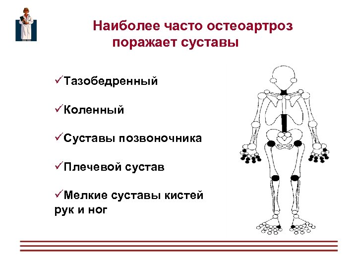 Остеоартроз карта вызова