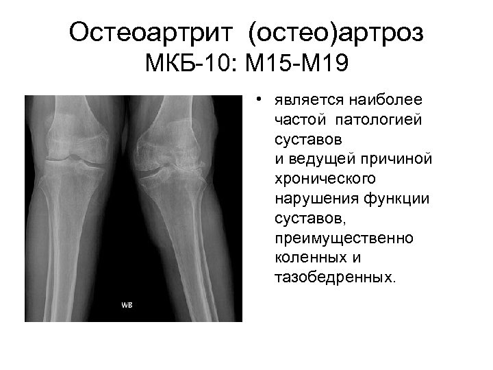 Артрит коленного сустава карта вызова