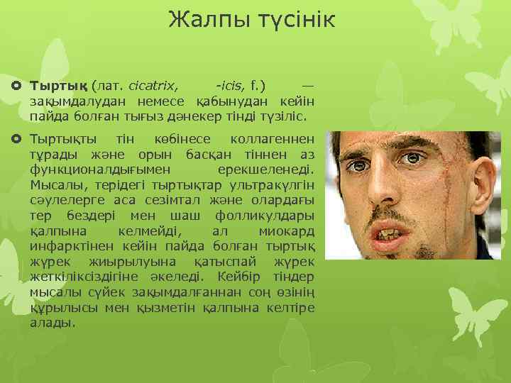 Жалпы түсінік Тыртық (лат. cicatrix, -icis, f. ) — зақымдалудан немесе қабынудан кейін пайда