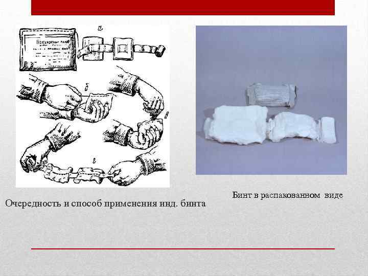 Очередность и способ применения инд. бинта Бинт в распакованном виде 