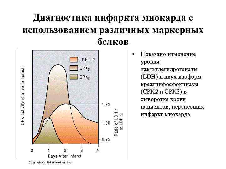 Диагностика инфаркта миокарда с использованием различных маркерных белков • Показано изменение уровня лактатдегидрогеназы (LDH)