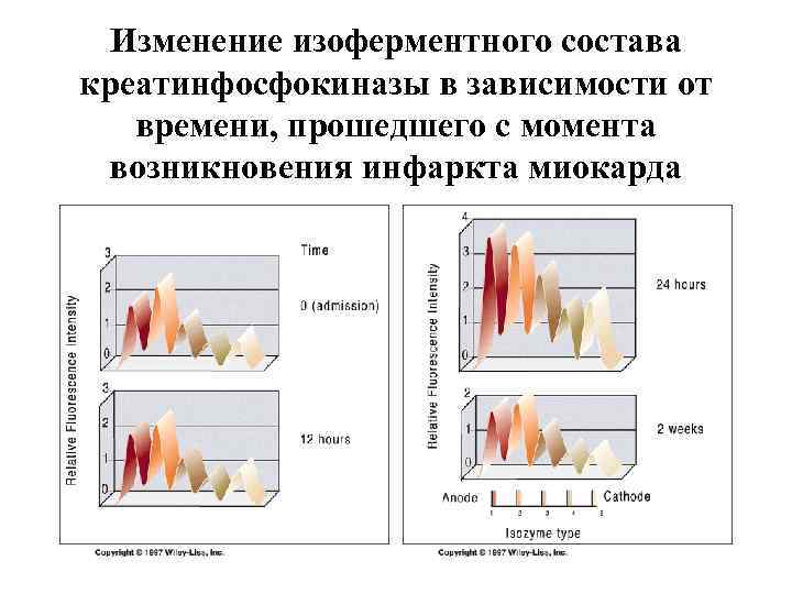 Изменение изоферментного состава креатинфосфокиназы в зависимости от времени, прошедшего с момента возникновения инфаркта миокарда