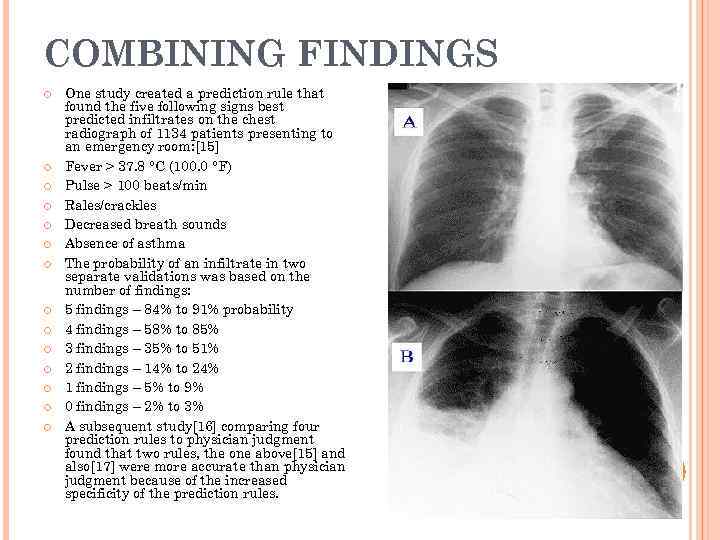 COMBINING FINDINGS One study created a prediction rule that found the five following signs