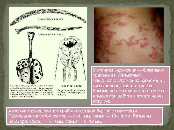 Механизм заражения — фекальнооральный и контактный. Чаще всего заражение происходит, когда человек ходит по