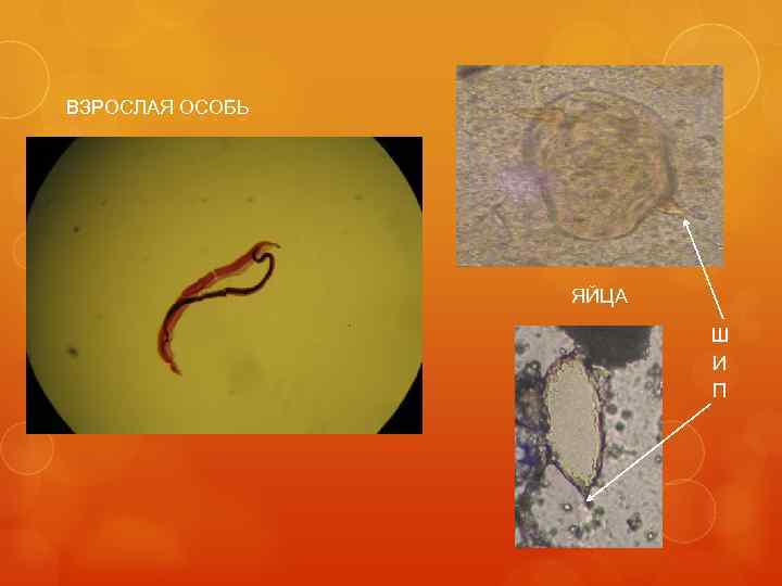 ВЗРОСЛАЯ ОСОБЬ ЯЙЦА Ш И П 