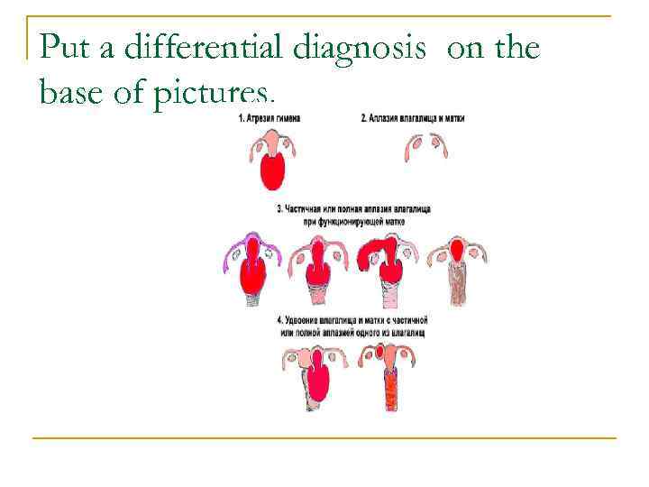 Put a differential diagnosis on the base of pictures. 