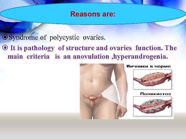 Reasons are: Syndrome of polycystic ovaries. It is pathology of structure and ovaries function.