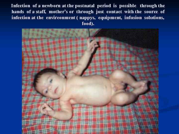 Infection of a newborn at the postnatal period is possible through the hands of