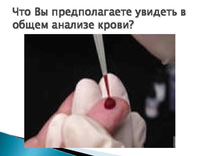 Что Вы предполагаете увидеть в общем анализе крови? 