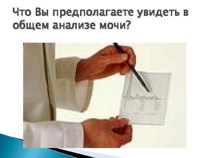 Что Вы предполагаете увидеть в общем анализе мочи? 