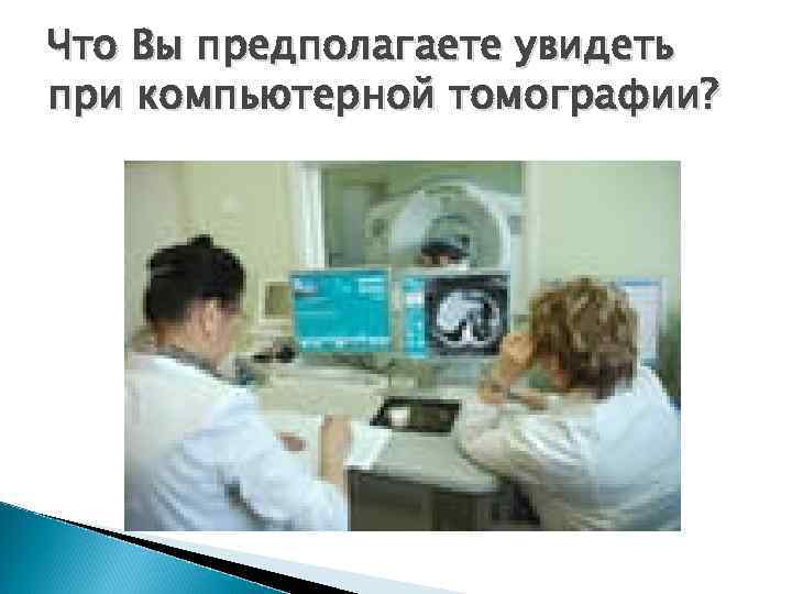 Что Вы предполагаете увидеть при компьютерной томографии? 