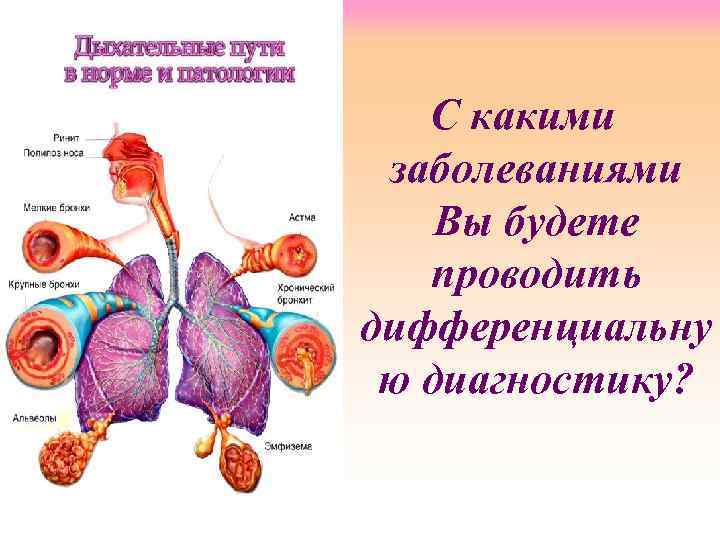 С какими заболеваниями Вы будете проводить дифференциальну ю диагностику? 