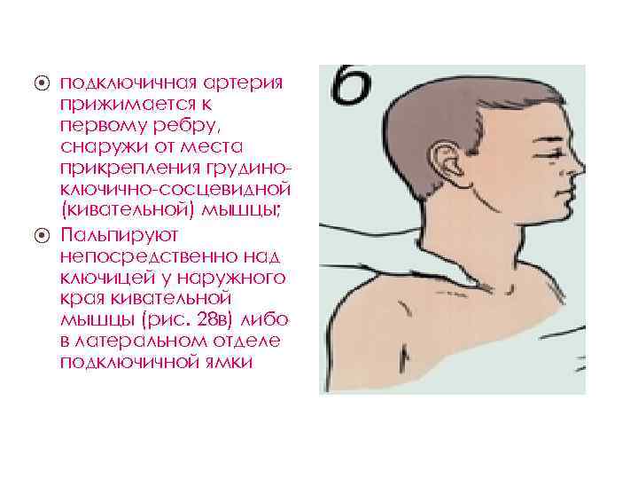 подключичная артерия прижимается к первому ребру, снаружи от места прикрепления грудино ключично сосцевидной (кивательной)