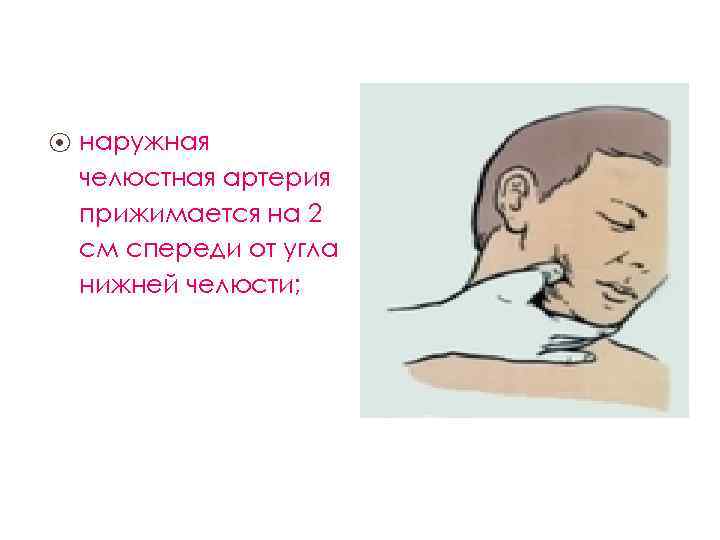 ⦿ наружная челюстная артерия прижимается на 2 см спереди от угла нижней челюсти; 